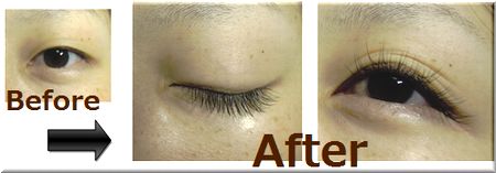 BeforeEAfter@Y.Ol